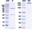 SDS-PAGE for Anti-Erbin Antibody (L4/6)