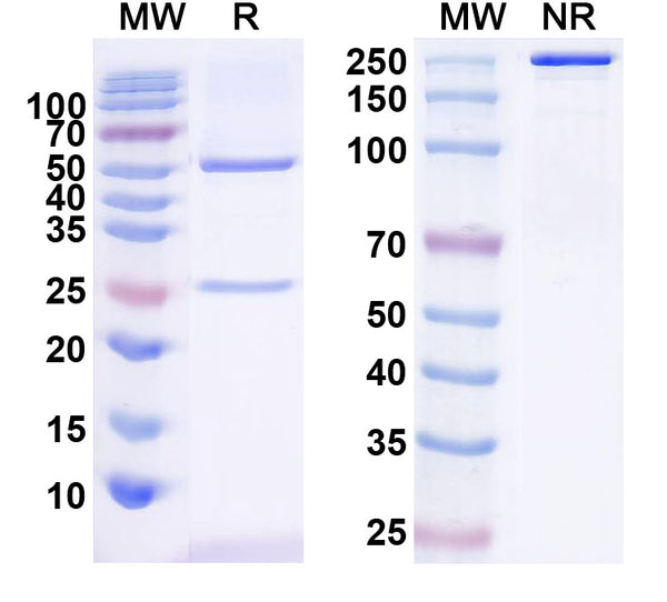 SDS-PAGE for Anti-Erbin Antibody (L4/6)