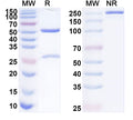 SDS-PAGE for Anti-Human PLAGL1 Antibody (SAA1920)