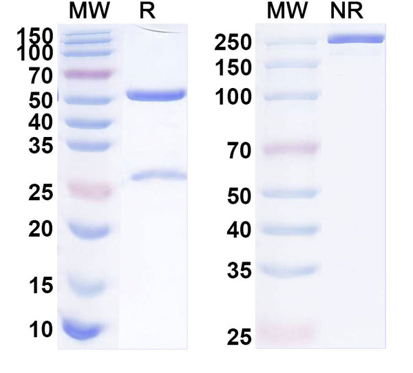 SDS-PAGE for Anti-Human PLAGL1 Antibody (SAA1920)