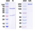 SDS-PAGE for Anti-Stonin-2 Antibody (N346/9)