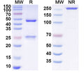SDS-PAGE for Anti-Human ANKZF1 Antibody (SAA2125)