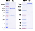 SDS-PAGE for Anti-Shank1 Antibody (N22/21)