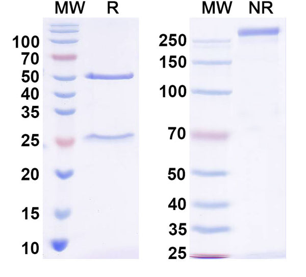 SDS-PAGE for Anti-Shank1 Antibody (N22/21)