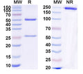 SDS-PAGE for Anti-Human ADGRG2/GPR64 Antibody (SAA1866)