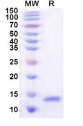 Recombinant Human SLC4A7 Protein, C-His