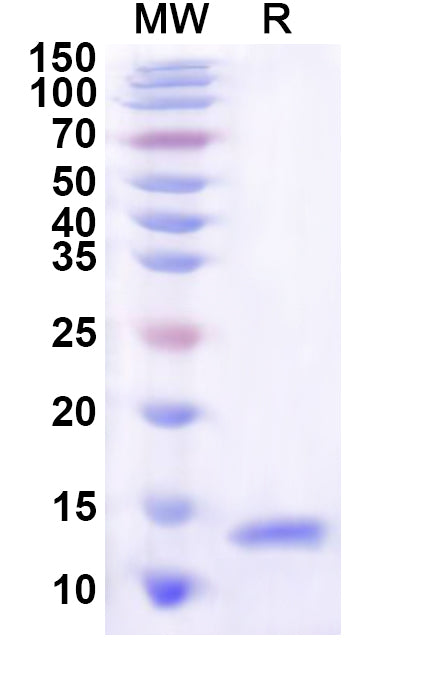 Recombinant Human SLC4A7 Protein, C-His