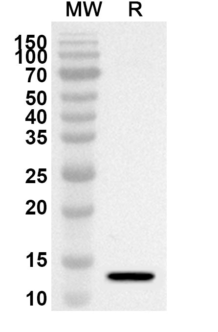 Western blot analysis was performed using anti-SLC4A7 polyclonal antibody at 1ug/mL on recombinant SLC4A7 (Catalog No. HA125012).