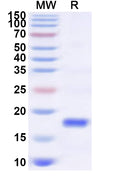 Recombinant Human SLC4A7 Protein, C-His