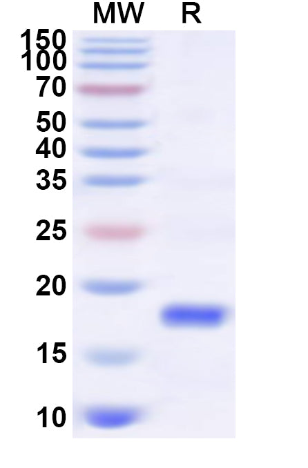 Recombinant Human SLC4A7 Protein, C-His