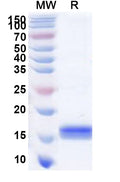 Recombinant Human SLC4A7 Protein, C-His