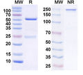 SDS-PAGE for Anti-NGL-2/LRRC4 Antibody (N50/24)