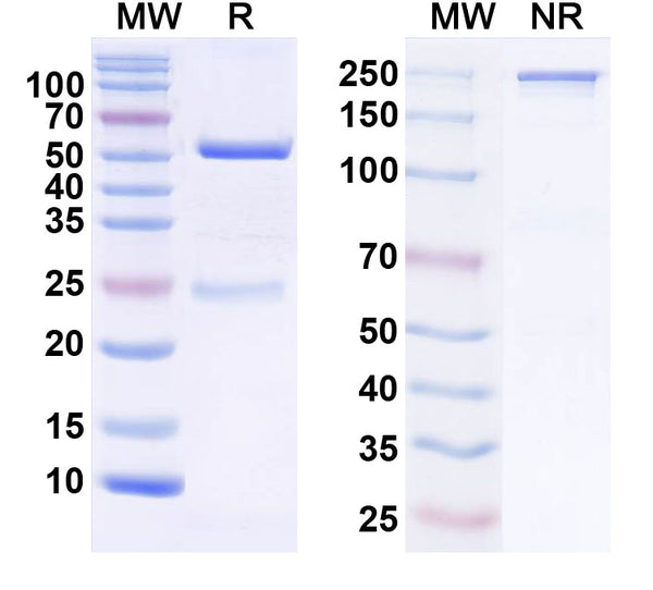 SDS-PAGE for Anti-NGL-2/LRRC4 Antibody (N50/37)