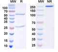 SDS-PAGE for Anti-ANO5/TMEM16E Antibody (N421A/50)