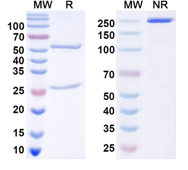 SDS-PAGE for Anti-ANO5/TMEM16E Antibody (N421A/50)