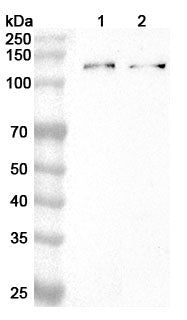 Western blot analysis was performed using anti-ATP13A1 polyclonal antibody at 1ug/mL on various samples.
Lane 1: Mouse heart lysate
Lane 2: Mouse brain lysate