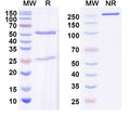 SDS-PAGE for Anti-Alpha-synuclein Antibody (N335/10)