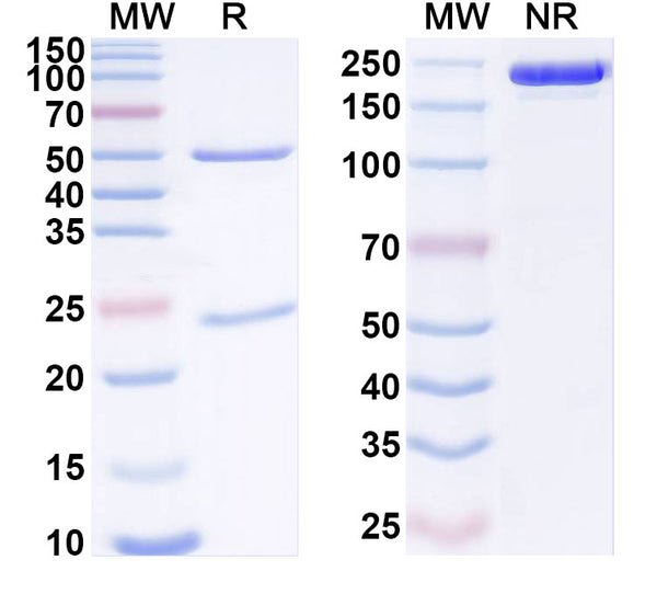SDS-PAGE for Anti-Human ADGRL4/ELTD1 Antibody (SAA1907)