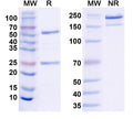 SDS-PAGE for Anti-GABA(A)R, Theta Antibody (L123/67)