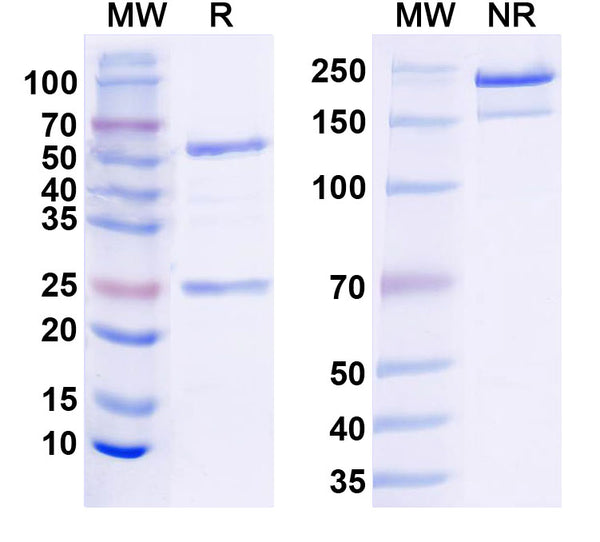 SDS-PAGE for Anti-GABA(A)R, Theta Antibody (L123/67)