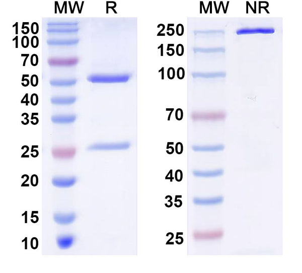 SDS-PAGE for Anti-GIT1 Antibody (N39B/24)