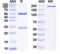 SDS-PAGE for Anti-Human CADM1 Antibody (SAA1897)