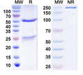 SDS-PAGE for Anti-Thioredoxin Antibody (N245/44)