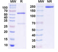 SDS-PAGE for Anti-GluN3A/NR3A glutamate receptor Antibody (K35/40)