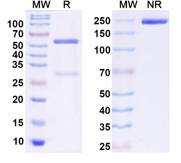 SDS-PAGE for Anti-GluN3A/NR3A glutamate receptor Antibody (N416/40)