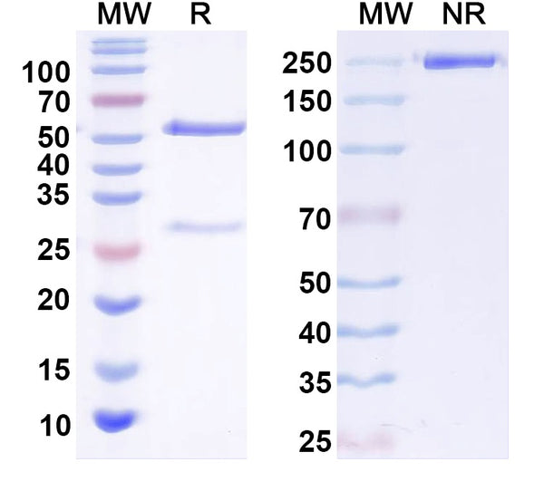SDS-PAGE for Anti-GluN3A/NR3A glutamate receptor Antibody (N427/64)