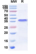 Recombinant Human ZNF449 Protein, N-His