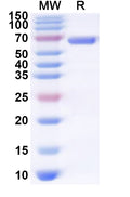 Recombinant Human OTUD1 Protein, N-His