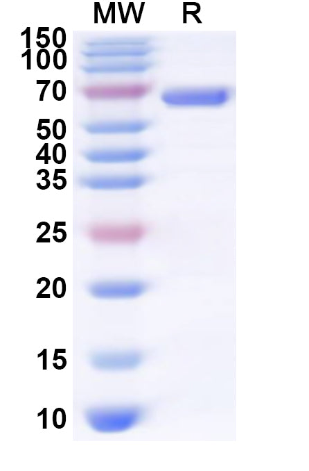Recombinant Human OTUD1 Protein, N-His