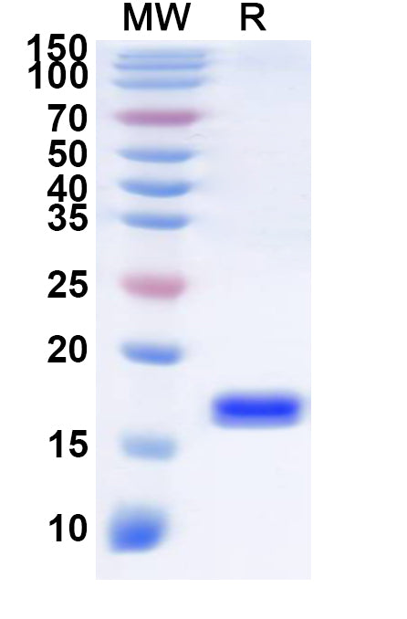 Recombinant Human SLC29A1 Protein, N-His