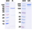 SDS-PAGE for Anti-GABA(B)R1 Antibody (N93A/35)