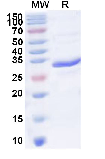 Recombinant Human MS4A4A Protein, N-His-KSI