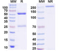 SDS-PAGE for Anti-Human ZSCAN21 Antibody (S116)