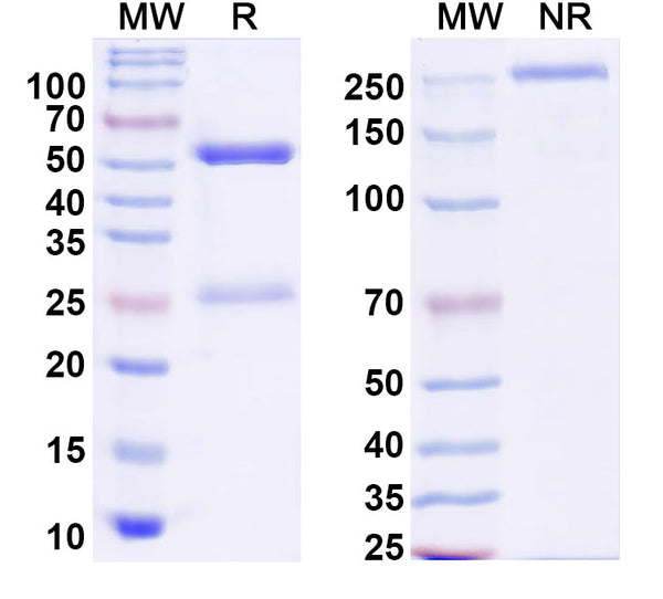 SDS-PAGE for Anti-Human ZSCAN21 Antibody (S116)