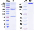 SDS-PAGE for Anti-Human ZSCAN21 Antibody (S117)