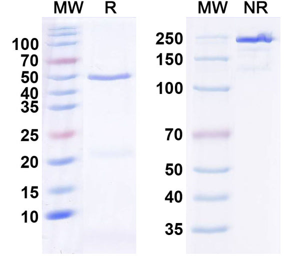 SDS-PAGE for Anti-SALM2/LRFN1 Antibody (N52B/27)