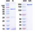 SDS-PAGE for Anti-ANO10/TMEM16K Antibody (N475A/5)