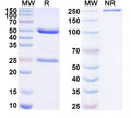 SDS-PAGE for Anti-Foxi3 Antibody (N359/28)