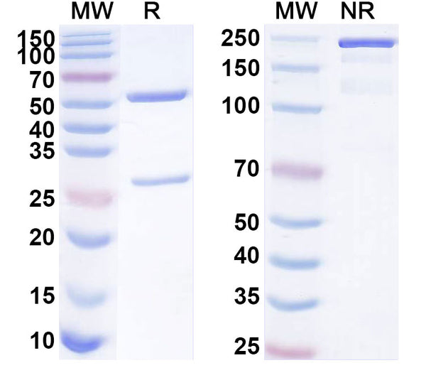 SDS-PAGE for Anti-Human CCSAP Antibody (SAA1842)