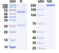 SDS-PAGE for Anti-Human C9orf72 Antibody (SAA1886)