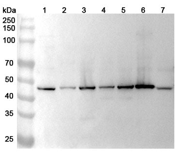 Western blot analysis was performed using anti-GALNS polyclonal antibody at 1ug/mL on various samples.
Lane 1: NIH3T3 cell lysate
Lane 2: Hela cell lysate
Lane 3: HepG2 cell lysate
Lane 4: MCF-7 cell lysate
Lane 5: HT-29 cell lysate
Lane 6: 293T cell lysate
Lane 7: N2A cell lysate