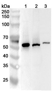 Western blot analysis was performed using anti-CCNA2 polyclonal antibody at 1ug/mL on various samples.
Lane 1: K562 cell lysate
Lane 2: HL-60 cell lysate
Lane 3: Raji cell lysate