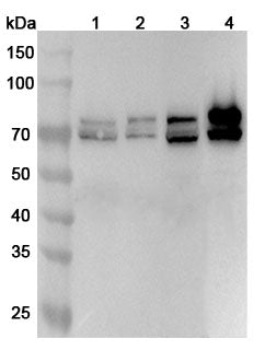 Western blot analysis was performed using anti-LMNA polyclonal antibody at 1ug/mL on various samples.
Lane 1: A549 cell lysate
Lane 2: Hela cell lysate
Lane 3: A375 cell lysate