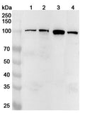 Western blot analysis was performed using anti-LONP1 polyclonal antibody at 1ug/mL on various samples.
Lane 1: Hela cell lysate
Lane 2: HepG2 cell lysate
Lane 3: Mouse heart lysate