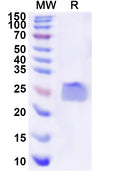 Recombinant Human GPX2 Protein, N-His