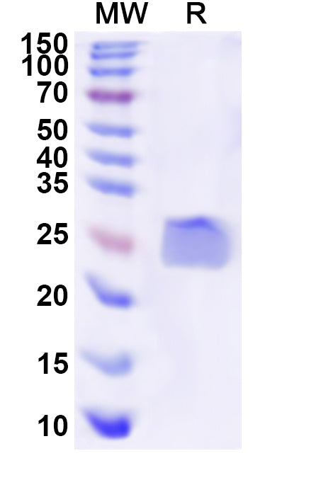 Recombinant Human GPX2 Protein, N-His